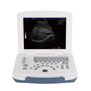 China BW Laptop Ultrasound Machine Full Digital Ultrasound Scanner GH580 on sale China BW Laptop Ultrasound Machine Full Digital Ultrasound Scanner GH580 on sale