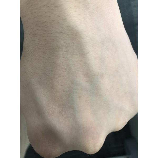 IP20 LED Linear Module For Hospital Injection Vascular Finder Medical Light