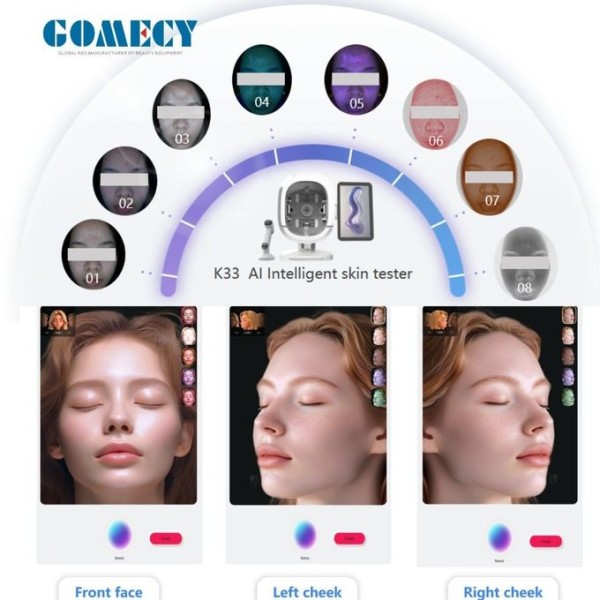 Complete Skin Analyzer Including A Scalp Analysis Handpiece A Large Screen And A High-Definition Camera