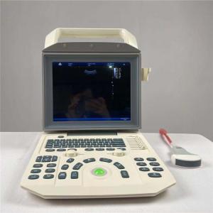 Wholesale Diagnostic B/W Ultrasound System All Digital For Obstetric And Gynecologic Hospital from china suppliers