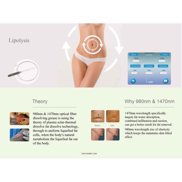 10.4 Inch Screen 980nm Diode Laser Physical Therapy Machine