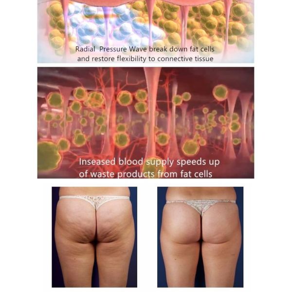Pain Relief Physical Therapy Laser Machine
