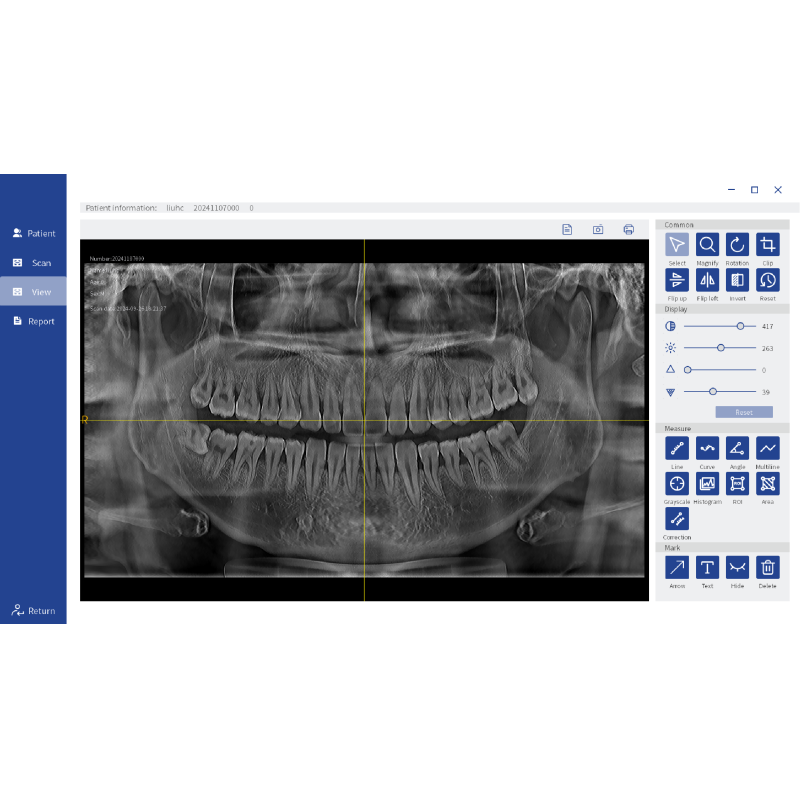 Dental Implant Orthodontic CBCT System High-Resolution 3D Imaging for Precise Diagnosis