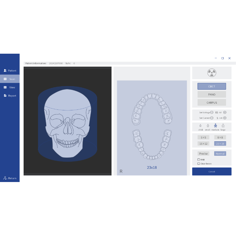 Dental Implant Orthodontic CBCT System High-Resolution 3D Imaging for Precise Diagnosis