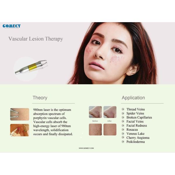 10.4 Inch Screen 980nm Diode Laser Physical Therapy Machine