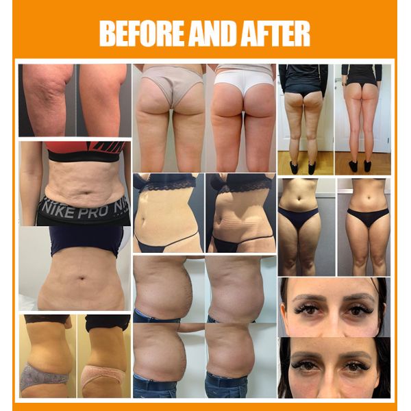Vertical Slimming Machine 7 In 1 Weight Loss Cellulite Treatment Device